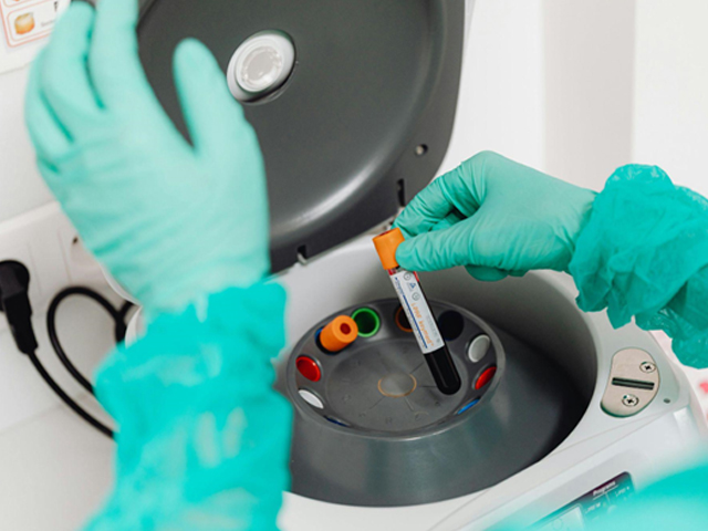 Don’t Ignore the Noise: Identifying Centrifuge Risks Before Equipment Failure